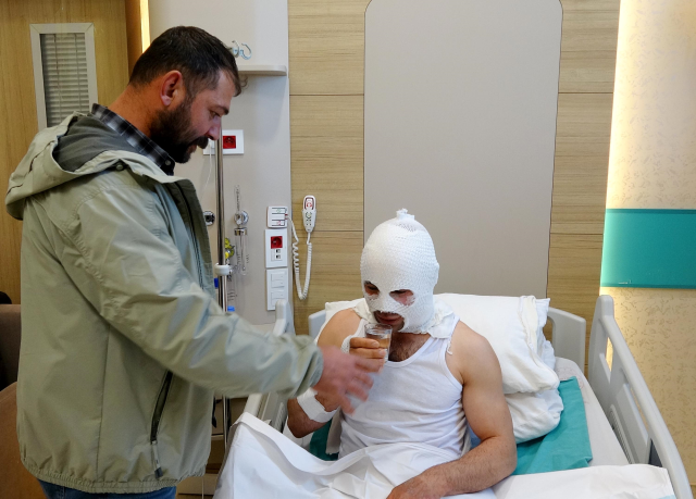 Nişanlısına hediye hazırlarken sprey boya kutusu bomba gibi patladı